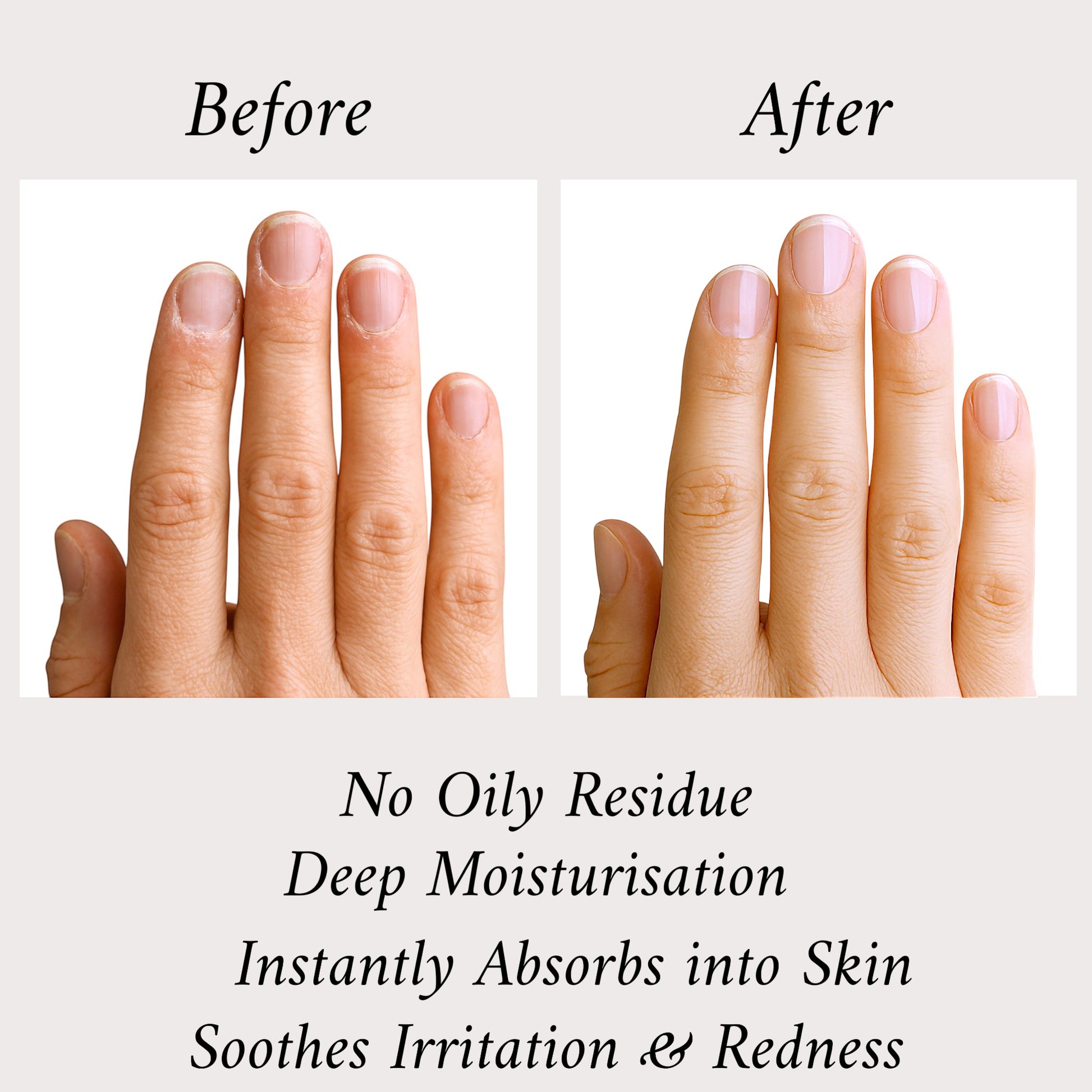 Kyco Nails 'Make It Last' comparison showing before and after nail and cuticle health. Features deep moisturisation and no oily residue.